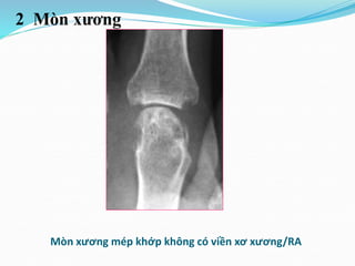 Máy ảnh cơ là gì So sánh máy ảnh cơ và máy ảnh số