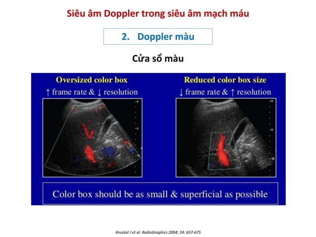 Bs Phuong - Nguyen ly co ban sieu am Doppler mach mau.pdf