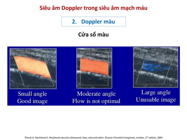 Bs Phuong - Nguyen ly co ban sieu am Doppler mach mau.pdf