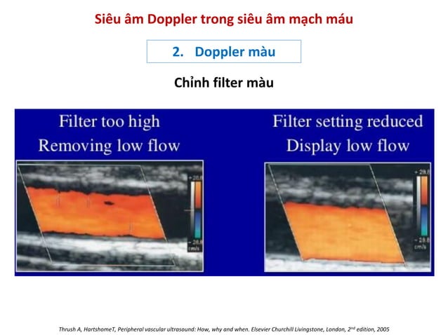 Bs Phuong - Nguyen ly co ban sieu am Doppler mach mau.pdf
