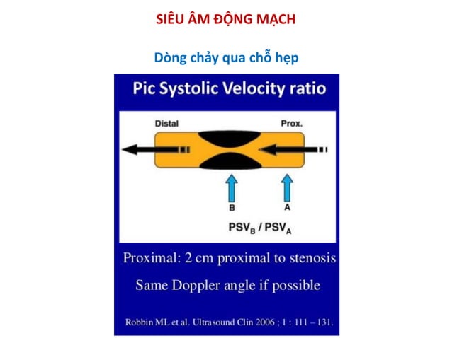 Bs Phuong - Nguyen ly co ban sieu am Doppler mach mau.pdf
