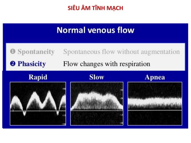 Bs Phuong - Nguyen ly co ban sieu am Doppler mach mau.pdf