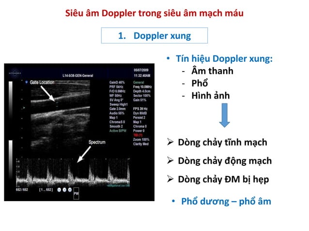 Bs Phuong - Nguyen ly co ban sieu am Doppler mach mau.pdf