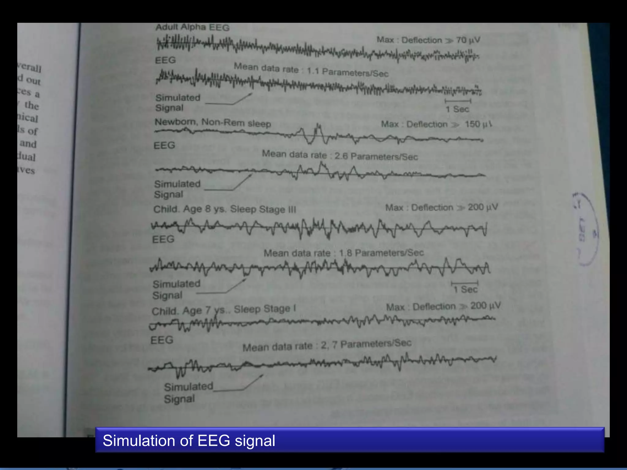 Simulation of EEG signal
                           Page 15
 