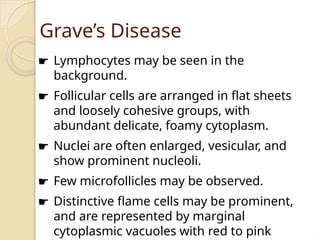 Grave’s Disease
☛ Lymphocytes may be seen in the
background.
☛ Follicular cells are arranged in flat sheets
and loosely cohesive groups, with
abundant delicate, foamy cytoplasm.
☛ Nuclei are often enlarged, vesicular, and
show prominent nucleoli.
☛ Few microfollicles may be observed.
☛ Distinctive flame cells may be prominent,
and are represented by marginal
cytoplasmic vacuoles with red to pink
 