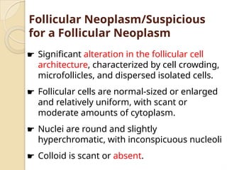 ☛ Significant alteration in the follicular cell
architecture, characterized by cell crowding,
microfollicles, and dispersed isolated cells.
☛ Follicular cells are normal-sized or enlarged
and relatively uniform, with scant or
moderate amounts of cytoplasm.
☛ Nuclei are round and slightly
hyperchromatic, with inconspicuous nucleoli
☛ Colloid is scant or absent.
Follicular Neoplasm/Suspicious
for a Follicular Neoplasm
 