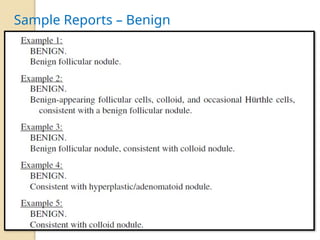 Sample Reports – Benign
 