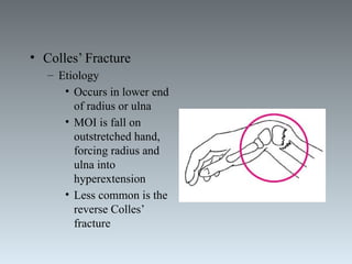 BSSH Overseas_ Anatomy of hand_ wrist and forearm.pptx
