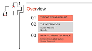 Overview
01
02
03
TYPE OF WOUND HEALING
Suture Material
Needle
THE INSTRUMENTS
Simple Interrupted Suture
Suture Removal
BASIC SUTURING TECHNIQUE
 
