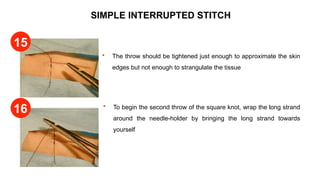 SIMPLE INTERRUPTED STITCH
 The throw should be tightened just enough to approximate the skin
edges but not enough to strangulate the tissue
 To begin the second throw of the square knot, wrap the long strand
around the needle-holder by bringing the long strand towards
yourself
15
16
 