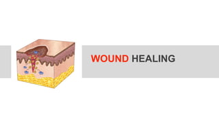 WOUND HEALING
 