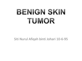 Siti Nurul Afiqah binti Johari 10-6-95
 