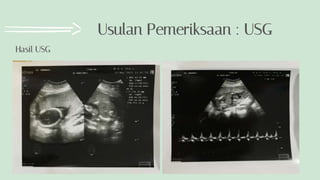 Hasil USG
Usulan Pemeriksaan : USG
 