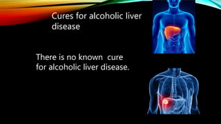 Cures for alcoholic liver
disease
There is no known cure
for alcoholic liver disease.
 
