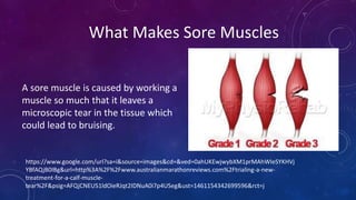 What Makes Sore Muscles
A sore muscle is caused by working a
muscle so much that it leaves a
microscopic tear in the tissue which
could lead to bruising.
https://www.google.com/url?sa=i&source=images&cd=&ved=0ahUKEwjwybXM1prMAhWIeSYKHVj
YBfAQjB0IBg&url=http%3A%2F%2Fwww.australianmarathonreviews.com%2Ftrialing-a-new-
treatment-for-a-calf-muscle-
tear%2F&psig=AFQjCNEU51ldOieRJqt2IDNuA0i7p4USeg&ust=1461154342699596&rct=j
 