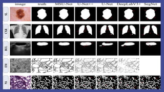 Deep Learning for Computer Vision: From Fundamentals to Medical Imaging ...
