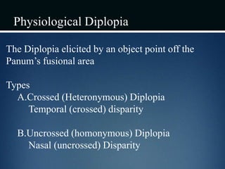 Physiological Diplopia
The Diplopia elicited by an object point off the
Panum’s fusional area
Types
A.Crossed (Heteronymous) Diplopia
Temporal (crossed) disparity
B.Uncrossed (homonymous) Diplopia
Nasal (uncrossed) Disparity
 