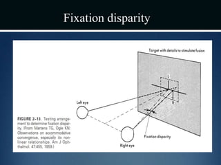 Fixation disparity
 
