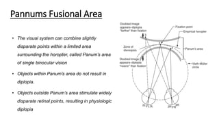 Pannums Fusional Area
• The visual system can combine slightly
disparate points within a limited area
surrounding the horopter, called Panum’s area
of single binocular vision
• Objects within Panum’s area do not result in
diplopia.
• Objects outside Panum’s area stimulate widely
disparate retinal points, resulting in physiologic
diplopia
 