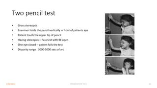 Two pencil test
• Gross stereopsis
• Examiner holds the pencil vertically in front of patients eye
• Patient touch the upper tip of pencil
• Having stereopsis – Pass test with BE open
• One eye closed – patient fails the test
• Disparity range : 3000-5000 secs of arc
3/30/2024 PRESENTATION TITLE 50
 