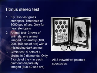 Timus Test binocular single vision in humans in detail | PPTX