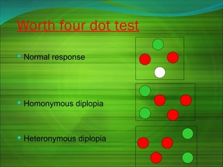 Worth four dot test
 Normal response
 Homonymous diplopia
 Heteronymous diplopia
 