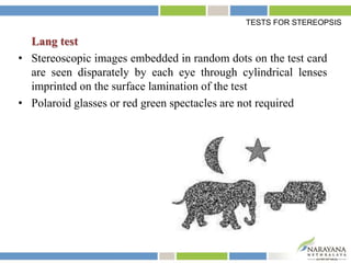 Lang test
• Stereoscopic images embedded in random dots on the test card
are seen disparately by each eye through cylindrical lenses
imprinted on the surface lamination of the test
• Polaroid glasses or red green spectacles are not required
TESTS FOR STEREOPSIS
 