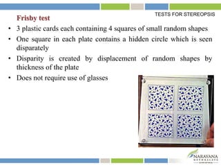 Frisby test
• 3 plastic cards each containing 4 squares of small random shapes
• One square in each plate contains a hidden circle which is seen
disparately
• Disparity is created by displacement of random shapes by
thickness of the plate
• Does not require use of glasses
TESTS FOR STEREOPSIS
 