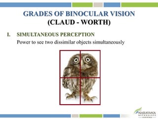 GRADES OF BINOCULAR VISION
(CLAUD - WORTH)
I. SIMULTANEOUS PERCEPTION
Power to see two dissimilar objects simultaneously
 