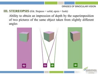 III. STEREOPSIS (Gk: Stepeos = solid, opsis = look)
Ability to obtain an impression of depth by the superimposition
of two pictures of the same object taken from slightly different
angles
GRADES OF BINOCULAR VISION
 