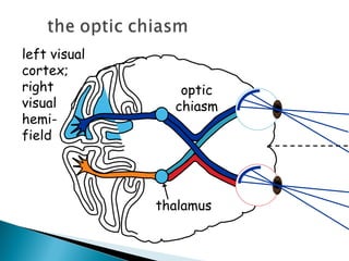thalamus
optic
chiasm
left visual
cortex;
right
visual
hemi-
field
 