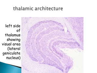 left side
of
thalamus
showing
visual area
(lateral
geniculate
nucleus)
 