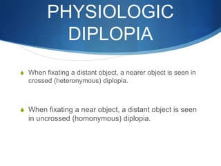 PHYSIOLOGIC
DIPLOPIA
S When fixating a distant object, a nearer object is seen in
crossed (heteronymous) diplopia.
S When fixating a near object, a distant object is seen
in uncrossed (homonymous) diplopia.
 