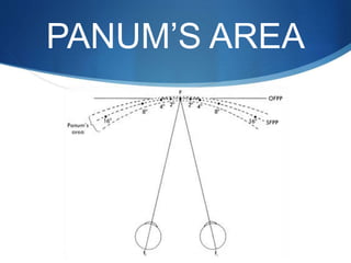 PANUM’S AREA
 