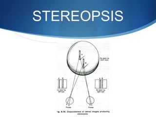 STEREOPSIS
 