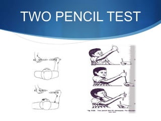 TWO PENCIL TEST
 
