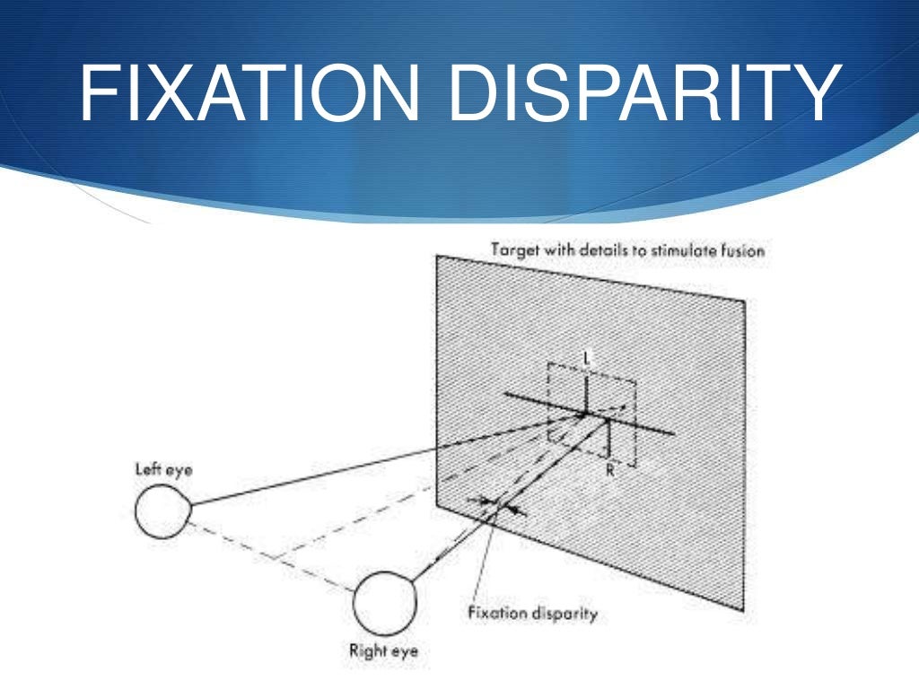 binocular single vision