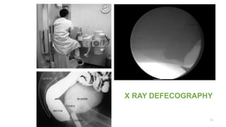 BS Võ Tấn Đức - MRI Defecography.pdf