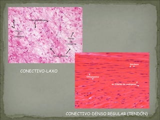 CONECTIVO-DENSO REGULAR (TENDÓN)
CONECTIVO-LAXO
 