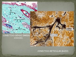 CONECTIVO-DENSO IRREGULAR
(DERMIS)
CONECTIVO-RETICULAR (BAZO)
 