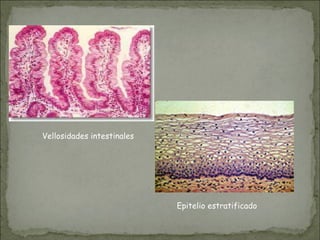 Vellosidades intestinales
Epitelio estratificado
 