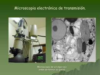 Microscopia electrónica de transmisión.
Microscopia de un alga roja
antes de formar su pared
 