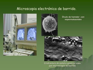 Microscopia electrónica de barrido.
Óvulo de hamster con
espermatozoides
Criofractura de epitelio gástrico vista
por microscopia de barrido
 