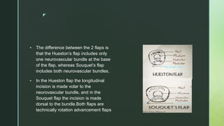 z
 The difference between the 2 flaps is
that the Hueston’s flap includes only
one neurovascular bundle at the base
of the flap, whereas Souquet’s flap
includes both neurovascular bundles.
 In the Hueston flap the longitudinal
incision is made volar to the
neurovascular bundle, and in the
Souquet flap the incision is made
dorsal to the bundle.Both flaps are
technically rotation advancement flaps
 