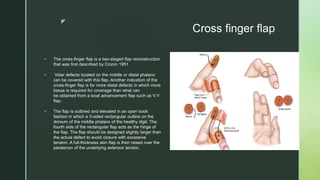 z
Cross finger flap
 The cross-finger flap is a two-staged flap reconstruction
that was first described by Cronin 1951
 Volar defects located on the middle or distal phalanx
can be covered with this flap. Another indication of the
cross-finger flap is for more distal defects in which more
tissue is required for coverage than what can
be obtained from a local advancement flap such as V-Y
flap.
 The flap is outlined and elevated in an open book
fashion in which a 3-sided rectangular outline on the
dorsum of the middle phalanx of the healthy digit. The
fourth side of the rectangular flap acts as the hinge of
the flap. The flap should be designed slightly larger than
the actual defect to avoid closure with excessive
tension. A full-thickness skin flap is then raised over the
paratenon of the underlying extensor tendon.
 