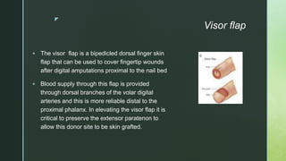 z
Visor flap
 The visor flap is a bipedicled dorsal finger skin
flap that can be used to cover fingertip wounds
after digital amputations proximal to the nail bed
 Blood supply through this flap is provided
through dorsal branches of the volar digital
arteries and this is more reliable distal to the
proximal phalanx. In elevating the visor flap it is
critical to preserve the extensor paratenon to
allow this donor site to be skin grafted.
 