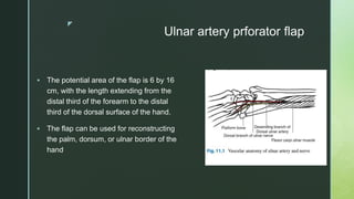 z
Ulnar artery prforator flap
 The potential area of the flap is 6 by 16
cm, with the length extending from the
distal third of the forearm to the distal
third of the dorsal surface of the hand.
 The flap can be used for reconstructing
the palm, dorsum, or ulnar border of the
hand
 