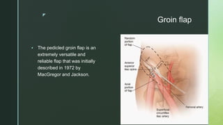 z
Groin flap
 The pedicled groin flap is an
extremely versatile and
reliable flap that was initially
described in 1972 by
MacGregor and Jackson.
 