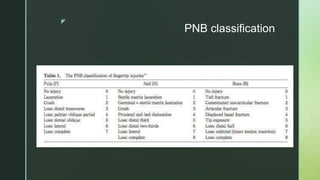 z
PNB classification
 