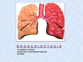 B R O N C H I E C T A S I S
DR. SHRIRAM .S. SHENOY
RESIDENT, DEPT. OF RESPIRATORY MEDICINE,
SBKS MIRC.
 